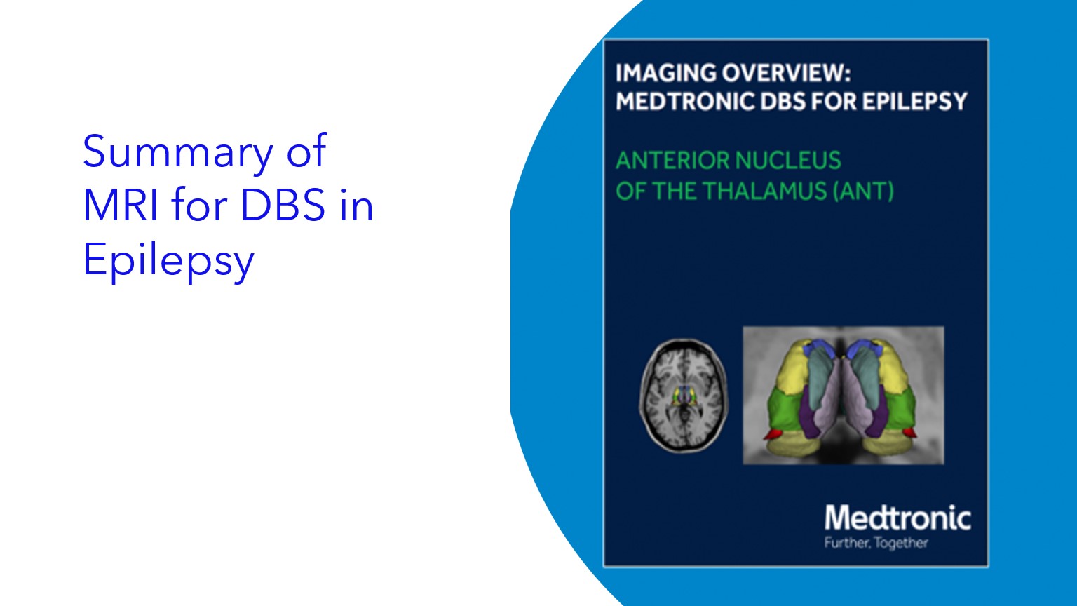 Summary of MRI for DBS in Epilepsy|Resumen de resonancia magnética para estimulación cerebral profunda en epilepsia|Resumo da Ressonância Magnética para DBS em Epilepsia