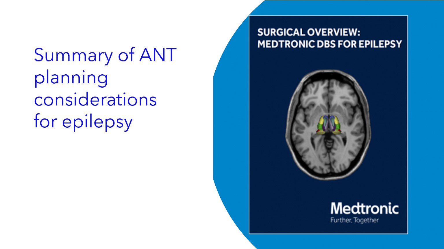 Summary of ANT planning considerations for epilepsy|Resumen de consideraciones de planificación de ANT para la epilepsia|Resumo das considerações de planejamento de TAR para epilepsia